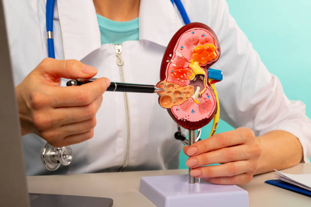 Kidney Transplant Success Rates at Livasa Mohali - Expert Outcomes
